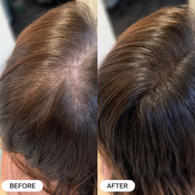 Bloomere Repair Spray - Eliminates Hair Shedding