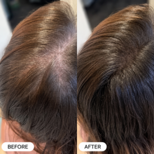 Bloomere Repair Spray - Eliminates Hair Shedding