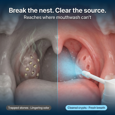Oralieve Tonsil Stone Cleaner